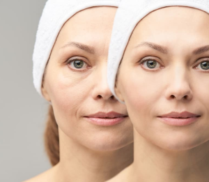 Skin Resurfacing & Facial Rejuvenation In Bahrain - Stanford Clinic