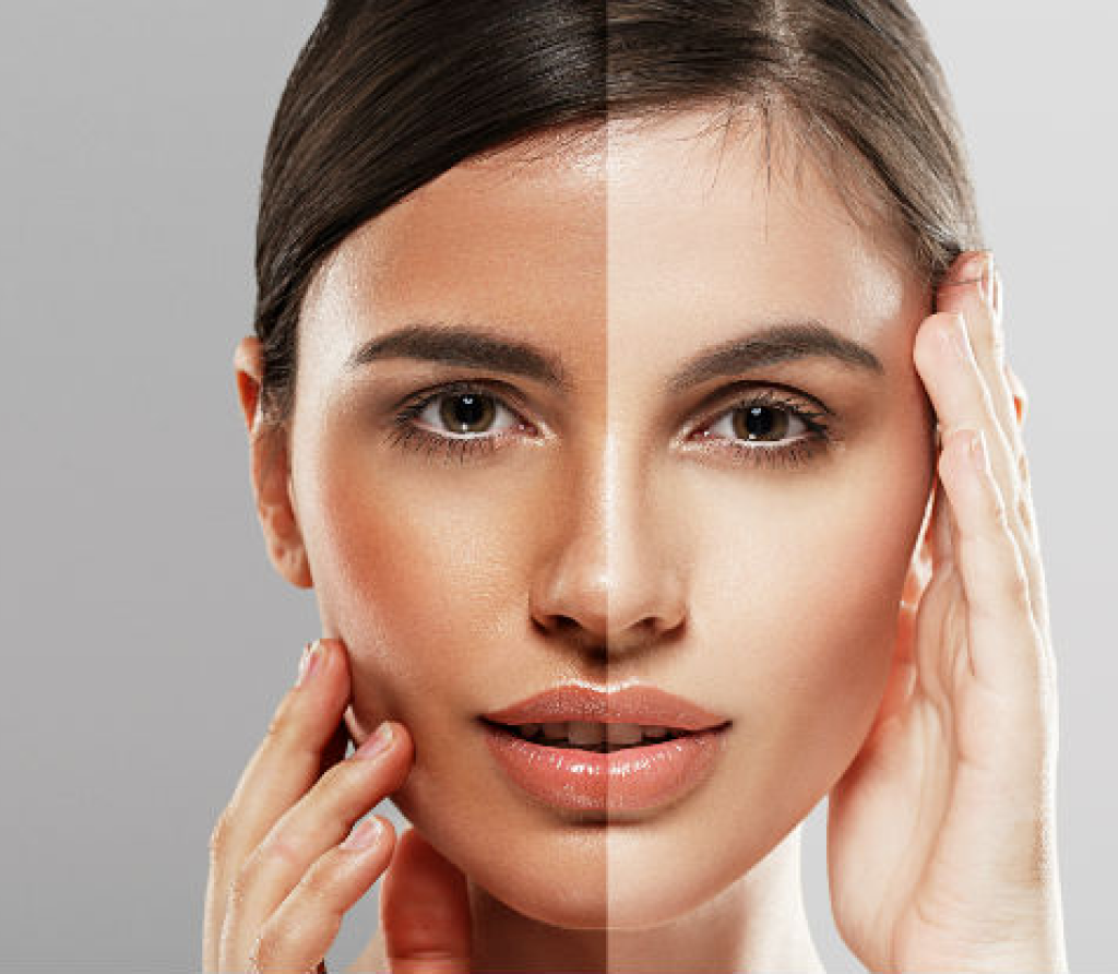 Skin whitening treatment in Bahrain